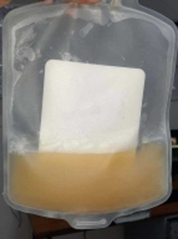 भोपाल में कोरोना मरीजों के लिए चलेगा प्लाज्मा डोनेशन अभियान